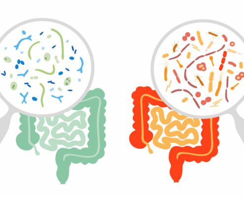 roleca_biom_good_bad roleca mikrobiom gut schlecht